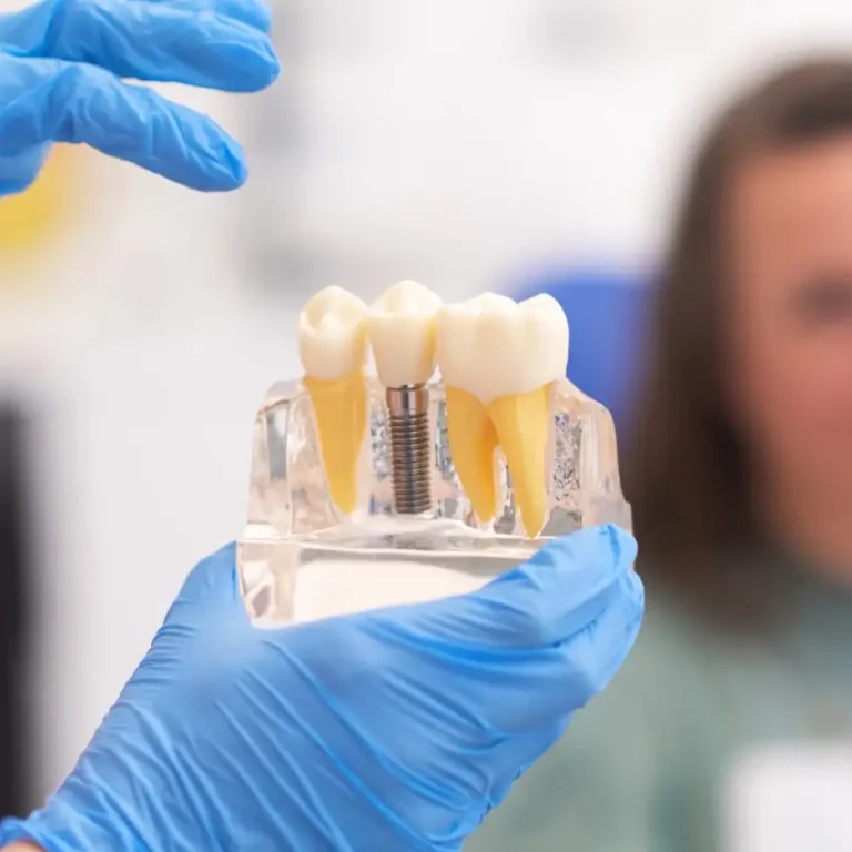 Close-up of dental model with implant. patient of dental clinic on blurred background. dentistry