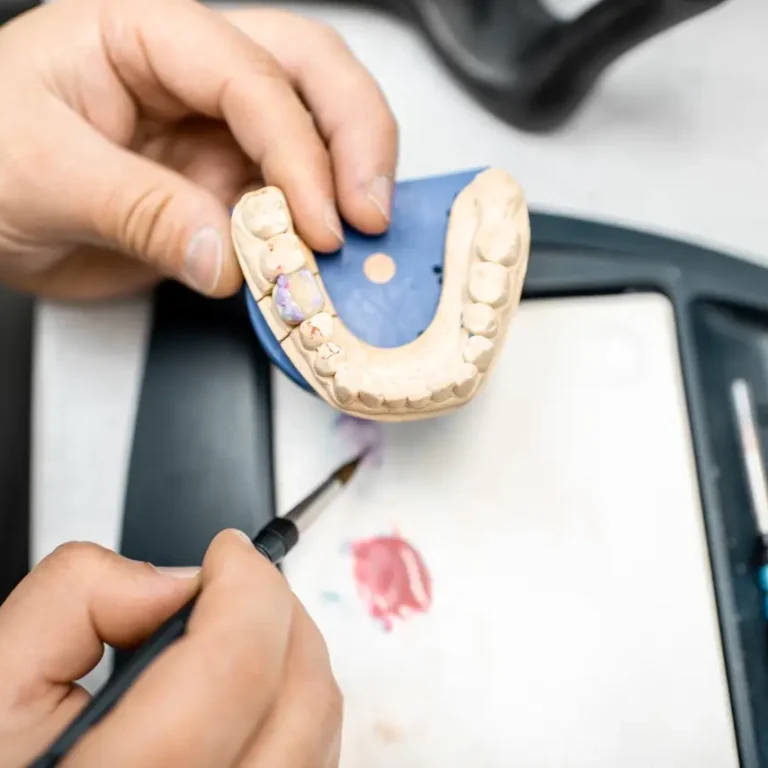 Dental technician coloring dental prosthesis
