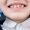 Boy showing teeth at dental check up. Close-up of dentist's hand with dental tools - probe and mirror in dental office. Dentistry